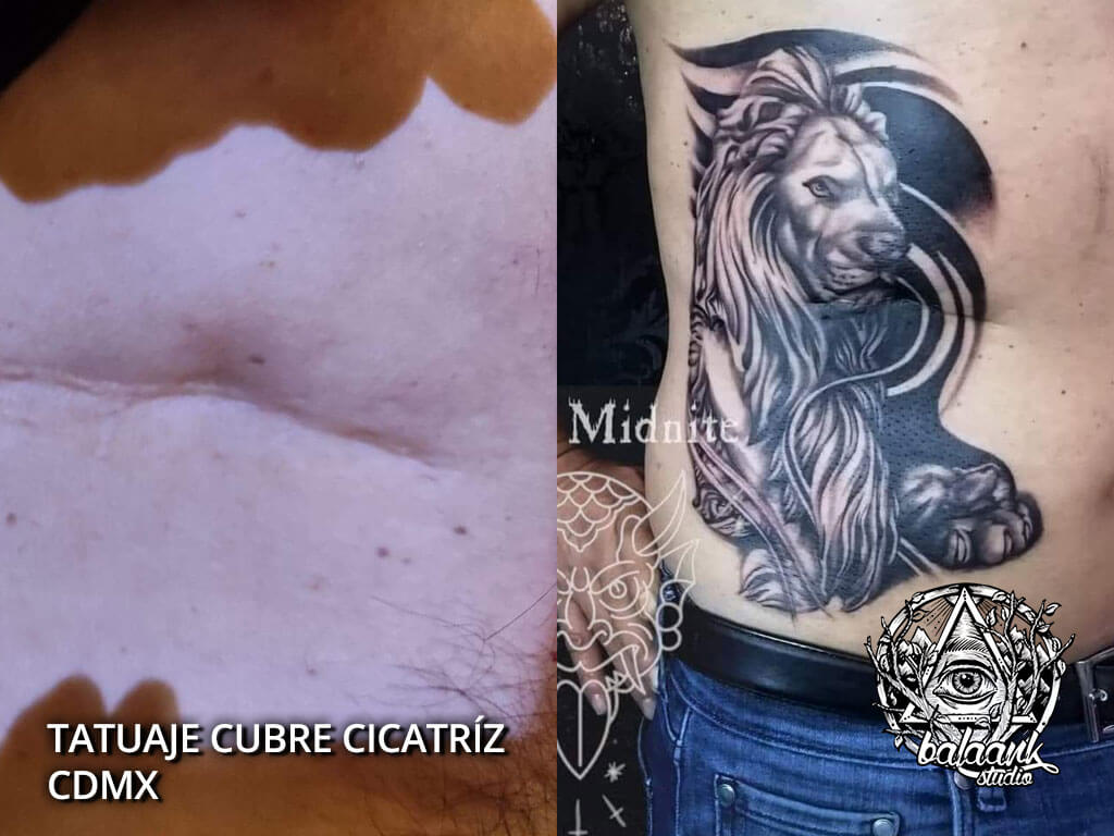 Tatuaje cubre Cicatriz CDMX