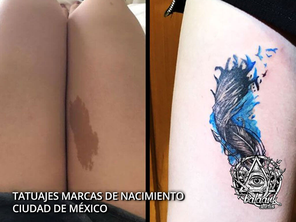 Tatuajes Marcas de Nacimiento Ciudad de Mexico